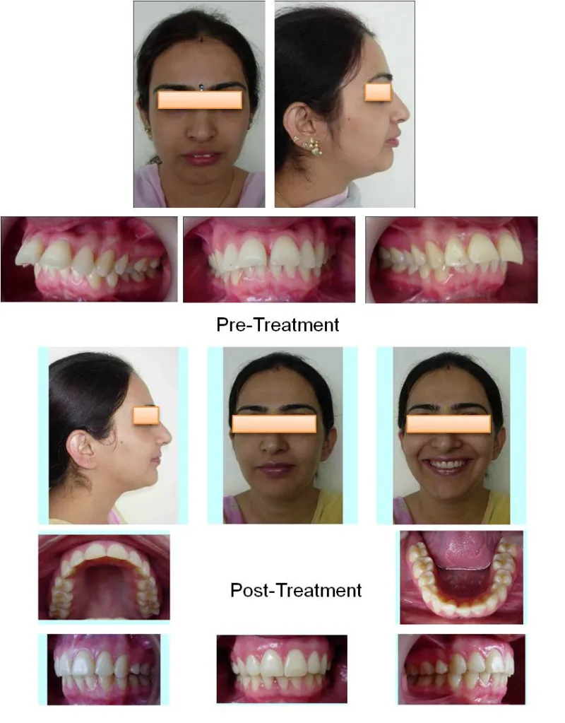 %20Adult%20%20Orthodontics
