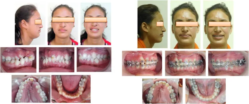 %20Cleft%20Lip%20&%20Cleft%20Palate