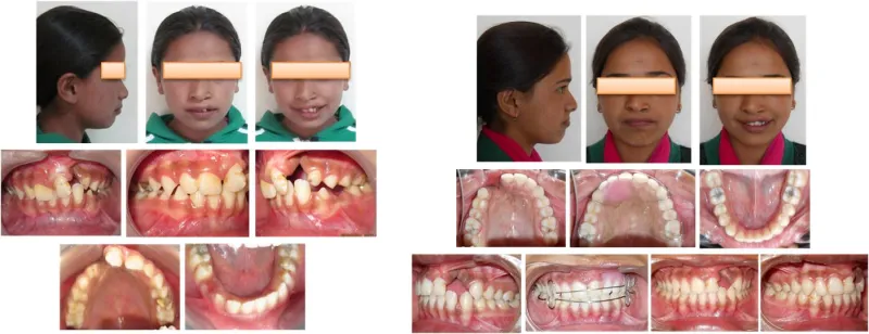 %20Cleft%20Lip%20&%20Cleft%20Palate